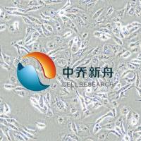 Caki-1人肾透明细胞癌皮肤转移细胞