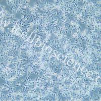 NUGC-4细胞、NUGC4细胞、NUGC4、NUGC-4、人胃癌细胞/STR鉴定/镜像绮点（Cellverse）