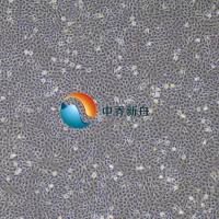 C643人甲状腺癌细胞