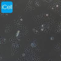 NCI-H292细胞、NCI-H292细胞、NCI-H292、人肺癌细胞(淋巴结转移)/STR鉴定/镜像绮点