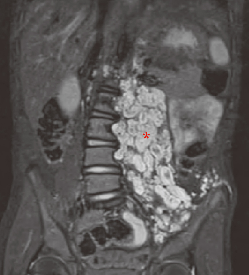 2025年FDA获批上市的激酶抑制剂会花落谁家呢？