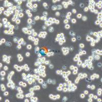 NB4人急性早幼粒白血病细胞