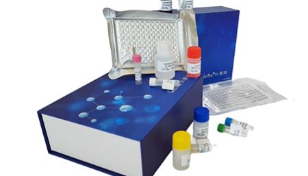 人血管内皮生长因子D(VEGFD)ELISA试剂盒实验质量控制操作综述