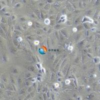 HuCCT1​人胆管上皮癌细胞