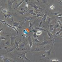 HMEC-1 人微血管内皮细胞