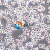 COLO 320HSR人结直肠腺癌细胞