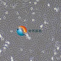 143B人骨肉瘤细胞