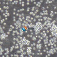 SU-DHL-10急性淋巴细胞