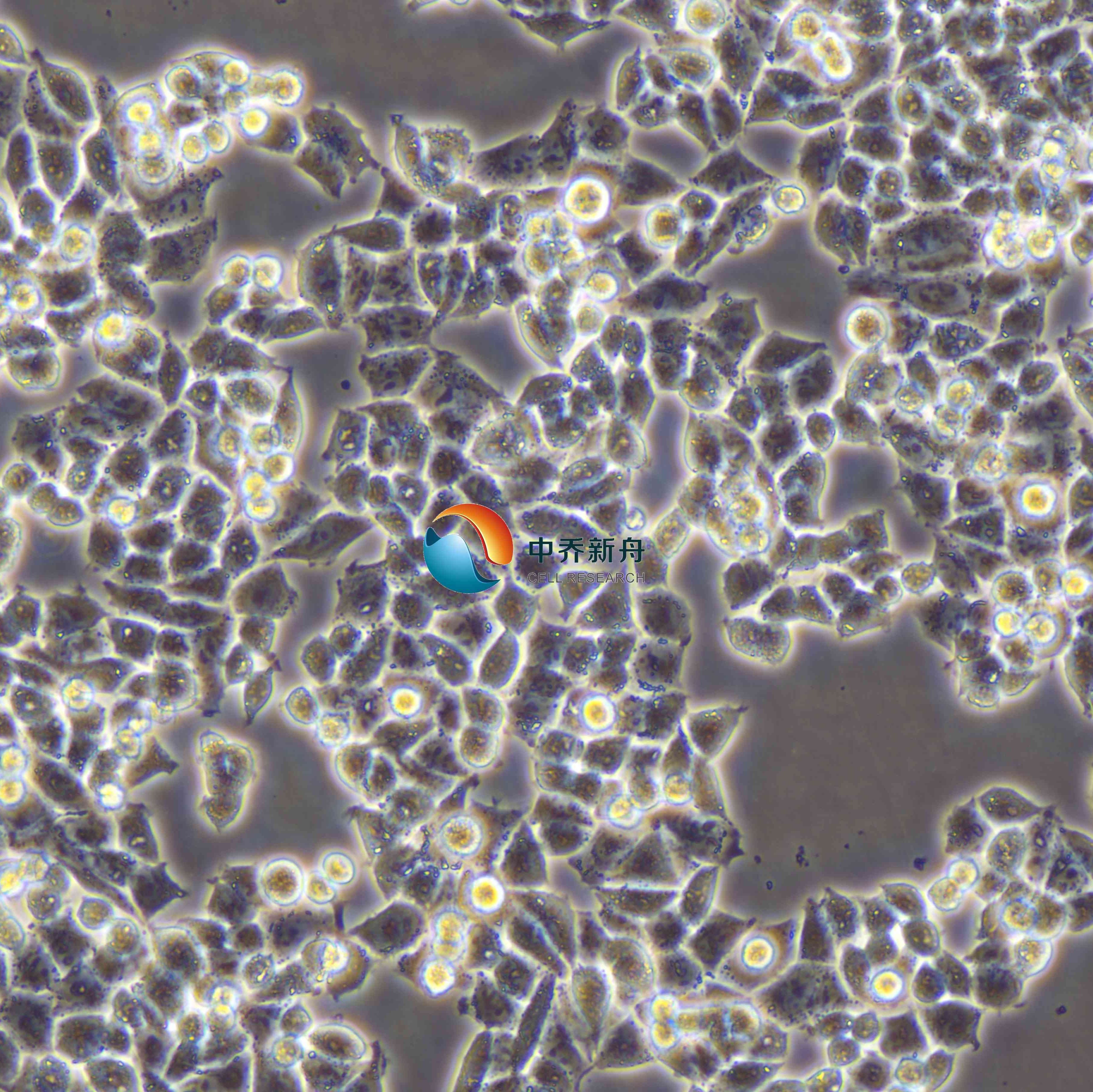 A2780人卵巢癌细胞