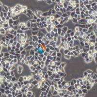 A2780人卵巢癌细胞