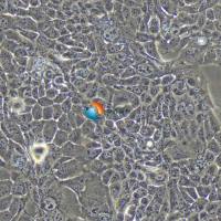 NCI-H441人肺腺癌细胞