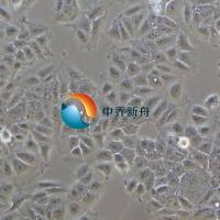 ISK人子宫内膜癌细胞