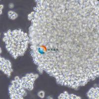 NK-92MI人恶性非霍奇金淋巴瘤患者的自然杀伤细胞