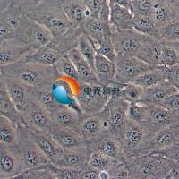 A875人黑色素瘤细胞