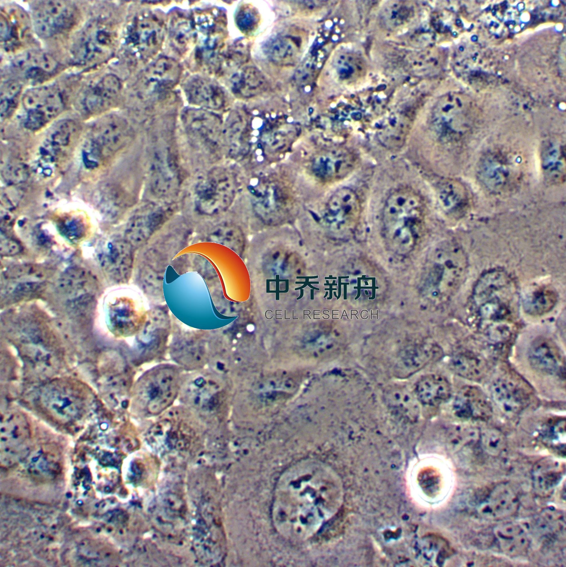 LTEP-S人肺鳞癌细胞