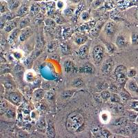 LTEP-S人肺鳞癌细胞