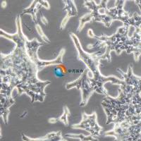 大鼠胰岛素瘤细胞INS-1