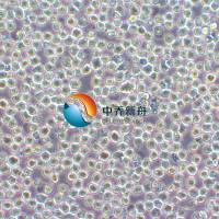 NCI-H929人骨髓瘤细胞株