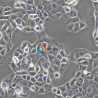 KLE人子宫内膜癌细胞