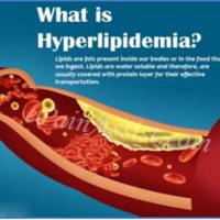 高脂饮食诱导高血脂模型