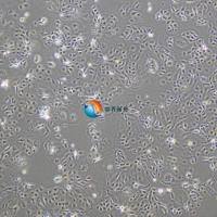 SW626人卵巢腺癌细胞