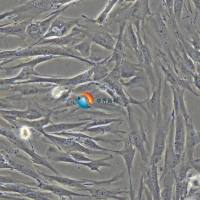 HFF-1人皮肤成纤维细胞