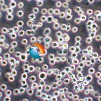 K-562人慢性髓原白血病细胞