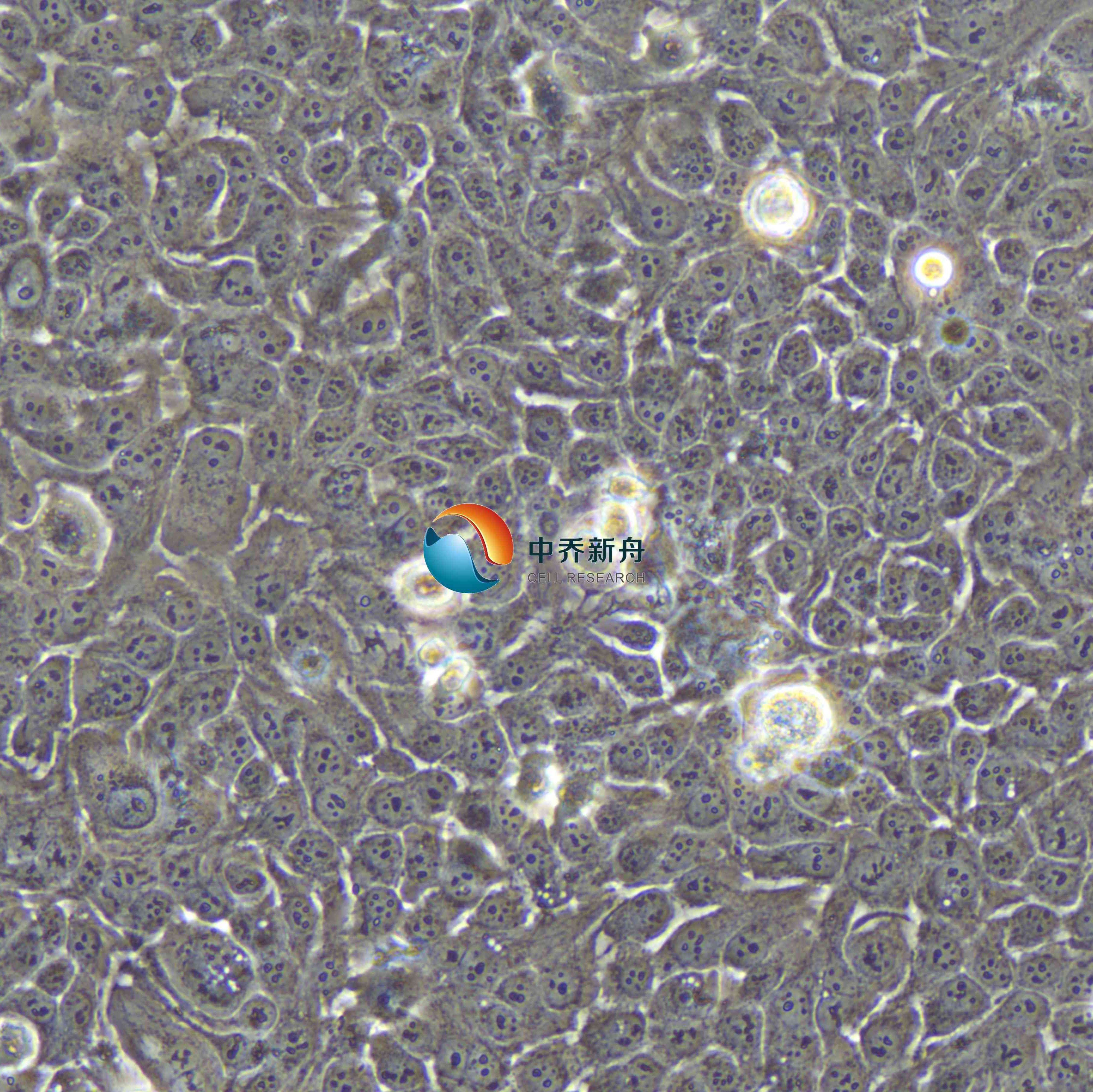 KYSE-150 人食管鳞癌细胞