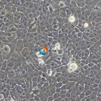 KYSE-150 人食管鳞癌细胞