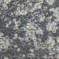 MIA PaCa-2人胰腺癌细胞