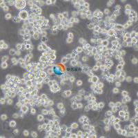 U266B1人外周淋巴细胞