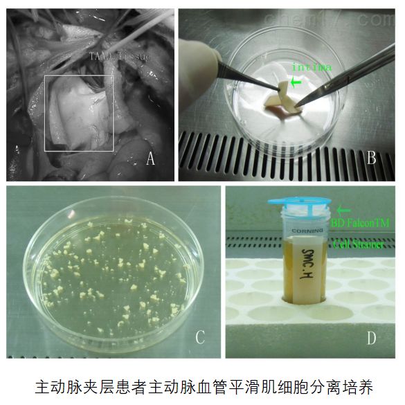 血管平滑肌细胞的分离与培养