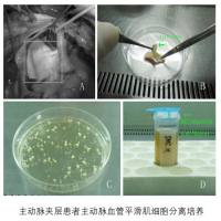 血管平滑肌细胞的分离与培养