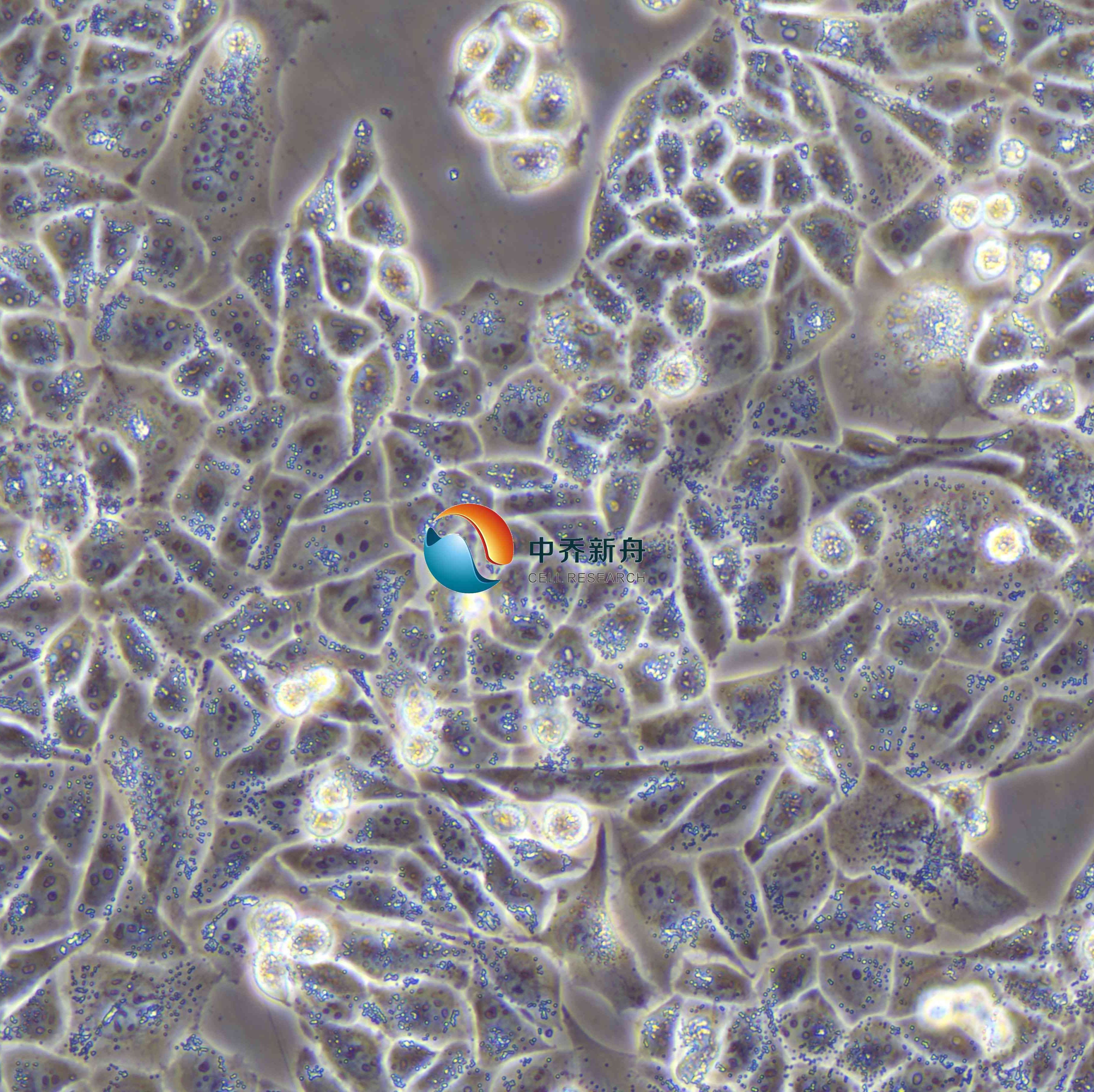 AN3CA​人子宫内膜癌细胞