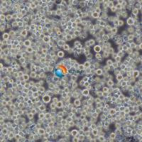 KG-1急性骨髓性白血病细胞