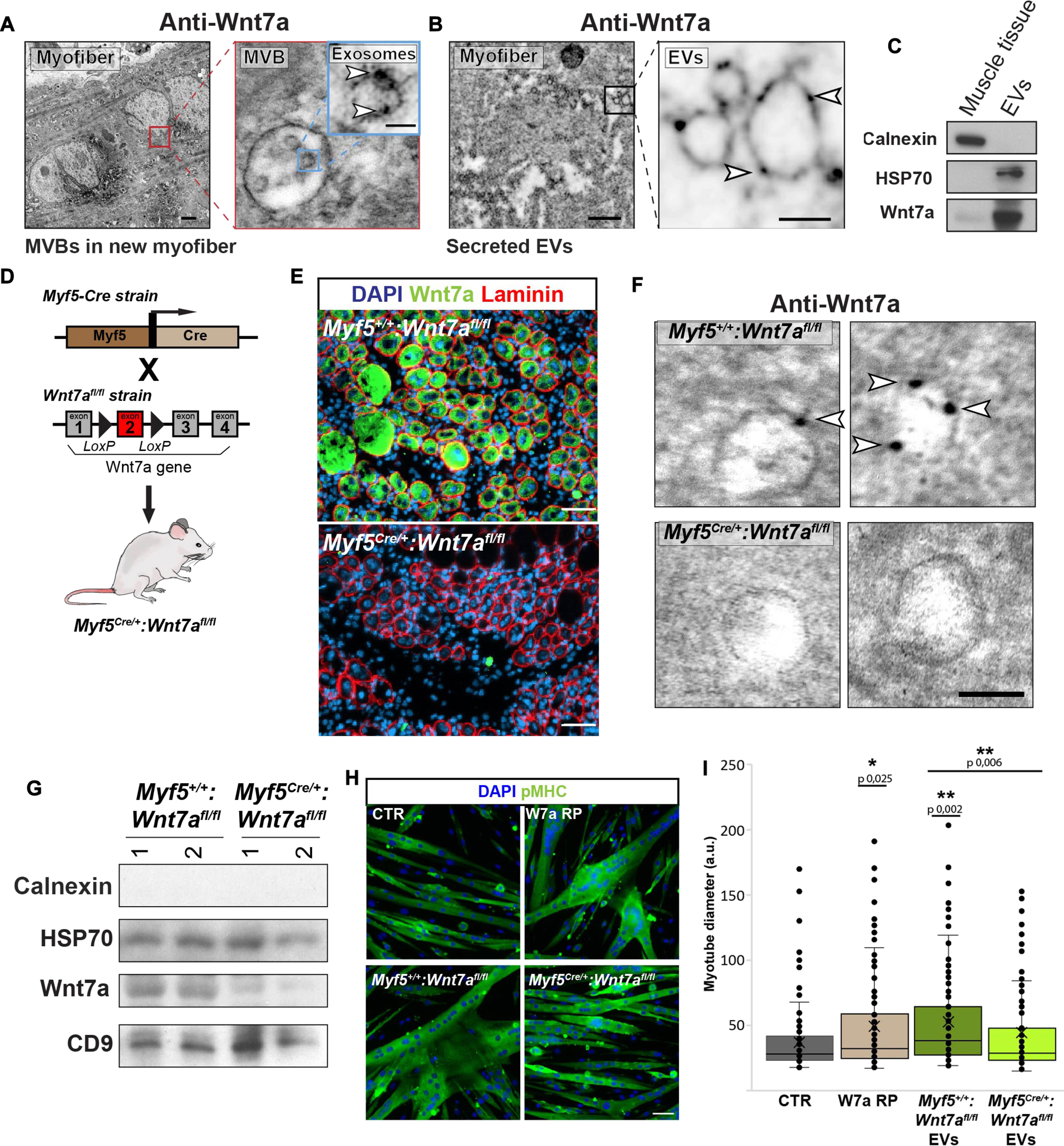 外泌体提取鉴定 外泌体提取鉴定