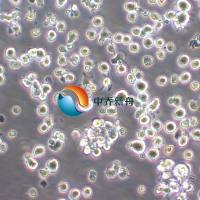 JVM-2 EB病毒感染的人外周淋巴细胞