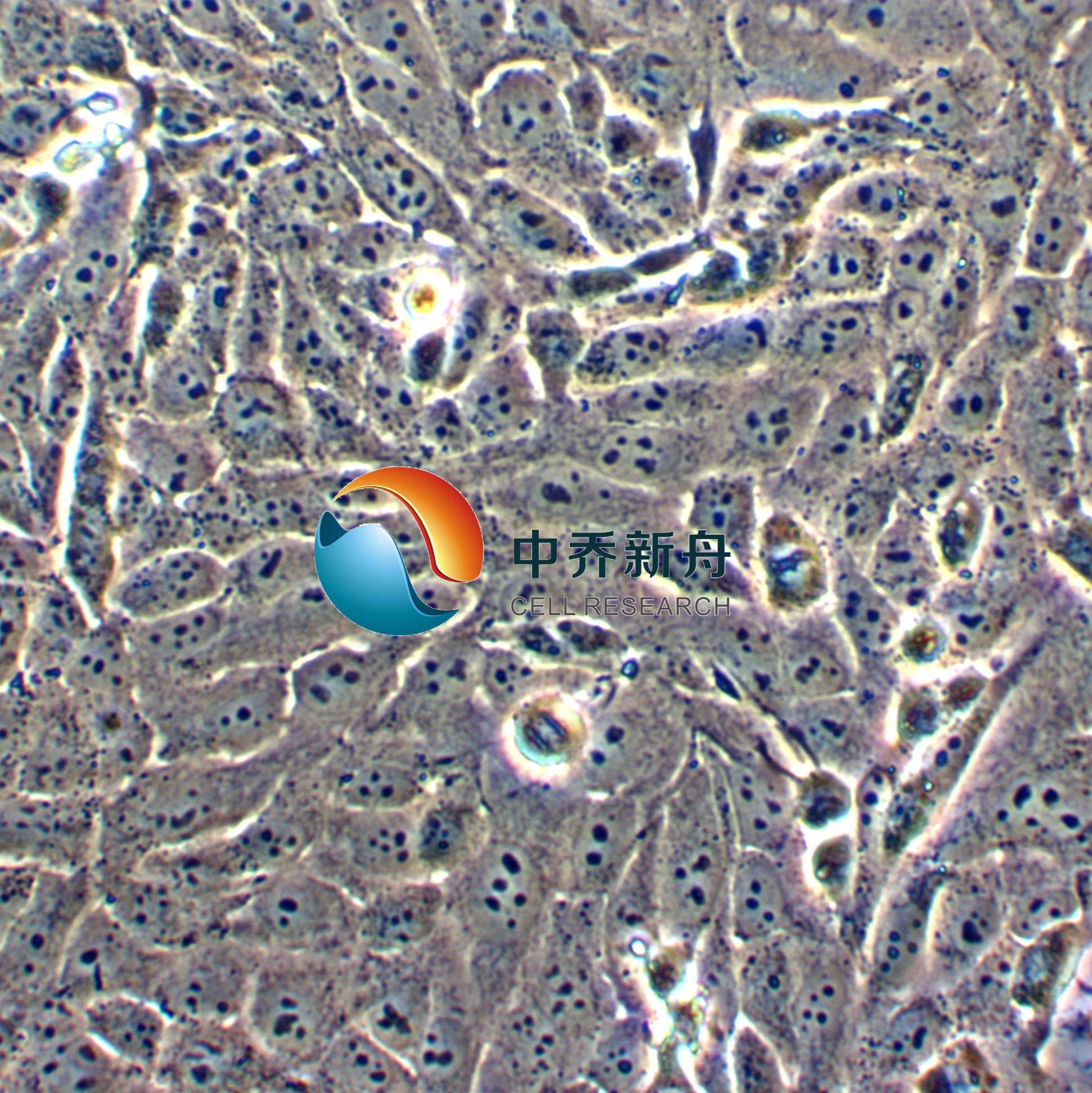 KHOS-240S人骨肉瘤细胞