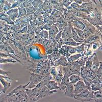 Huh-7.5.1人肝癌细胞