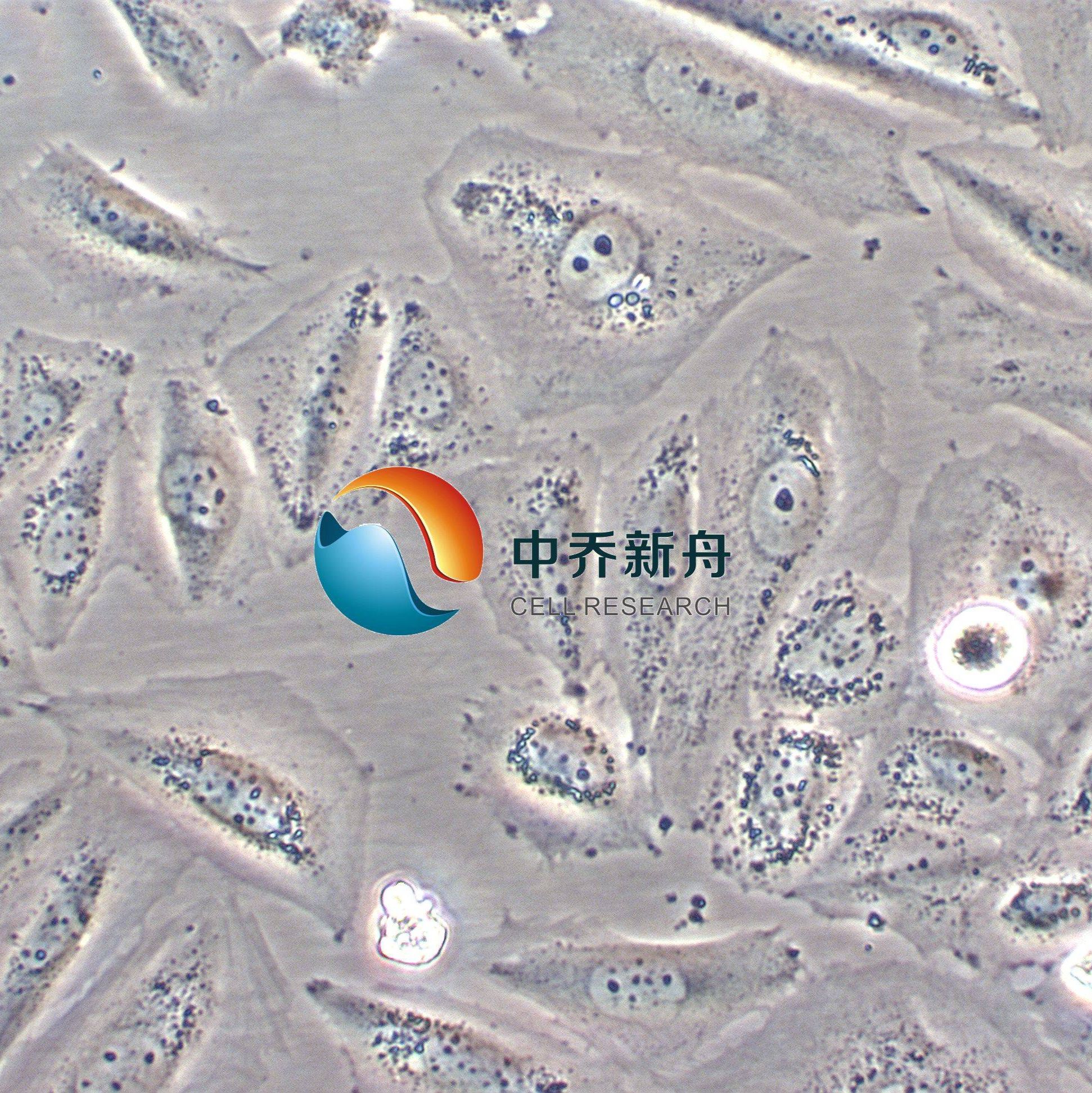 Saos-2人骨肉瘤细胞