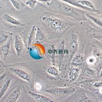 Saos-2人骨肉瘤细胞