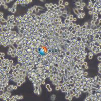 MKN-45人胃癌细胞