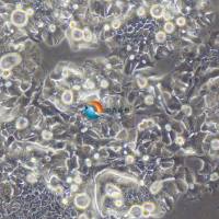 OE19人食管癌细胞