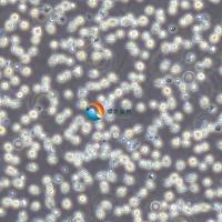 JeKo-1人套细胞淋巴瘤细胞