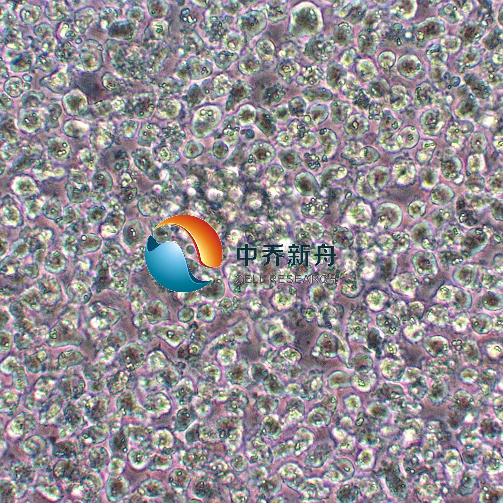 SU-DHL-1 ALK 阳性间变性大细胞淋巴瘤