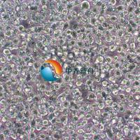 SU-DHL-1 ALK 阳性间变性大细胞淋巴瘤