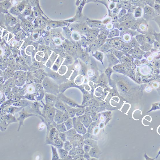 TE-10细胞 | TE10细胞 | TE-10 | TE10 | 人食管鳞癌细胞 | STR鉴定 | 镜像绮点(Cellverse)
