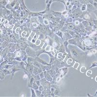 TE-10细胞 | TE10细胞 | TE-10 | TE10 | 人食管鳞癌细胞 | STR鉴定