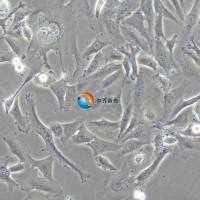 SW872人脂肪肉瘤细胞