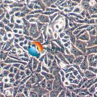 SK-UT-1人子宫平滑肌肉瘤细胞